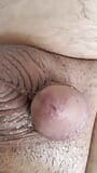 Prostaatvoorvocht met plassen snapshot 9