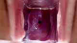 Baarmoederhals kloppend en stromend lekkend sperma tijdens close-up speculumspel snapshot 13