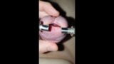 young urethra stretching to maximum, look inside and 10mm dilator inside snapshot 8