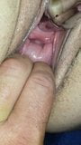 Peehole Dehnung snapshot 1