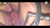 Huge Anal dilator with massive gape and nice Prolapse ending snapshot 9