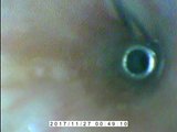 Endoskop e-stym wewnątrz cumming.avi snapshot 12