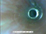 Endoscope E-stim inside Cumming.AVI snapshot 8