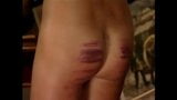 lupus pictures bonus pack spankings and canings snapshot 24