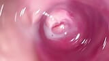 Camera inside my tight creamy pussy, Internal view of my horny vagina snapshot 14