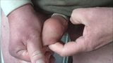 Three foreskin videos - over 30 minutes snapshot 8