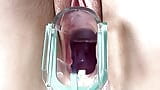 Baarmoederhals kloppend en stromend lekkend sperma tijdens close-up speculumspel snapshot 10