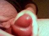 fat pumped foreskin snapshot 1